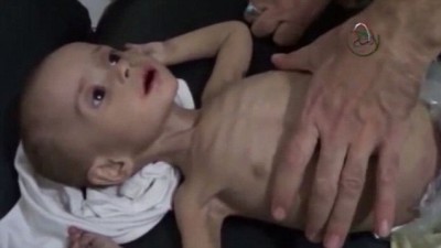 The children are not dying at the hands of war weapons - it is through starvation that they are dying a cruel and slow death. 