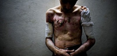 syria torture