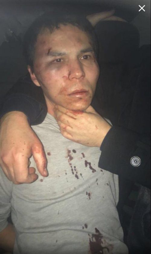 A bloodied looking Abdulkadir Masharipov pictured following arrest in Istanbul
