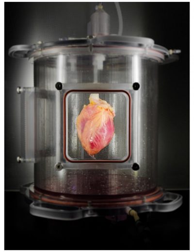 Regenerated heart Heart tissue, seeded with induced cardiac cells, matures in a bioreactor that the researchers created