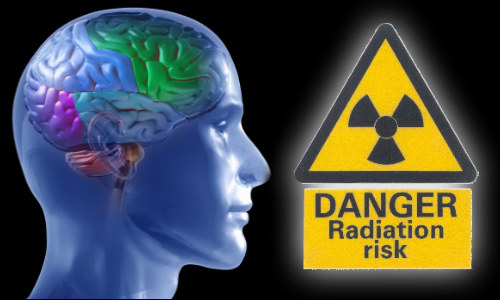 radiation risk