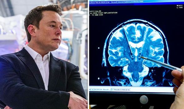 Elon Musk plans brain implants that will merge humans with AI creating cyborgs