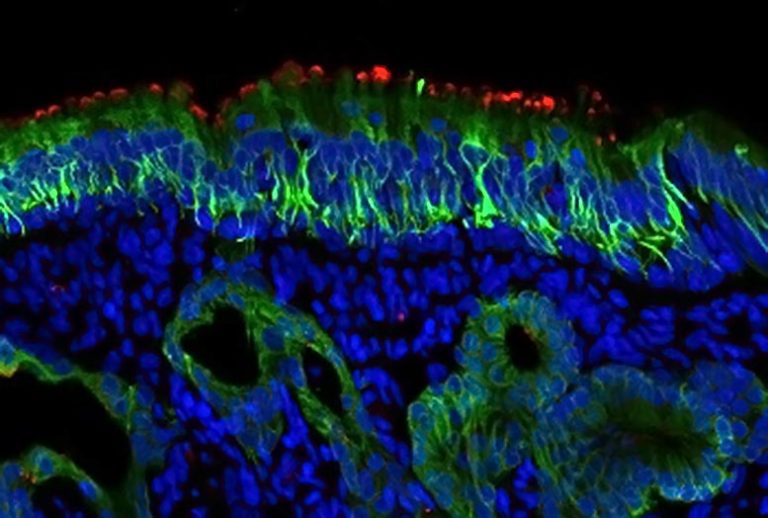 New evidence that cells in the nose are key entry point for COVID-19 ...