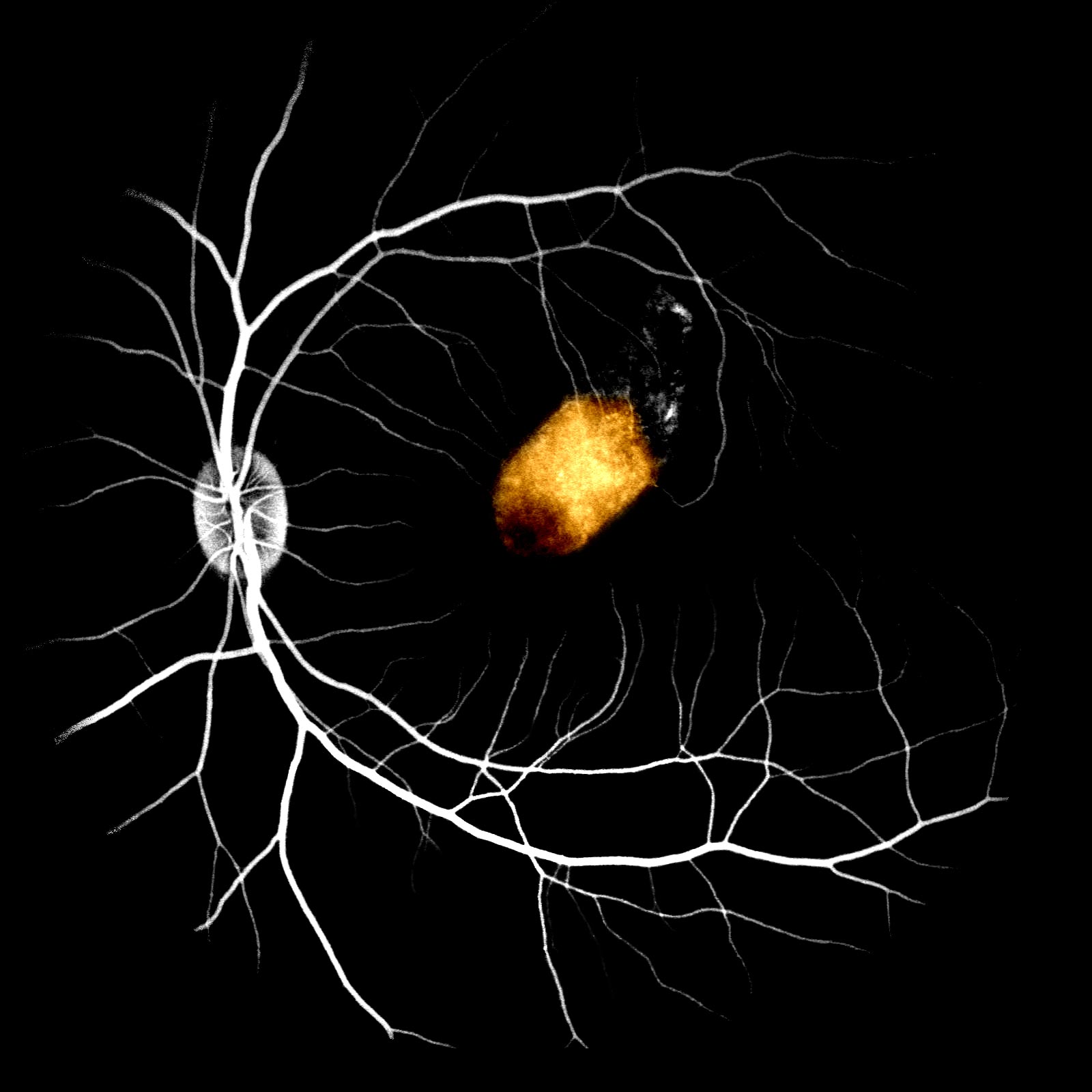 Cure for blindness insight with stem cell