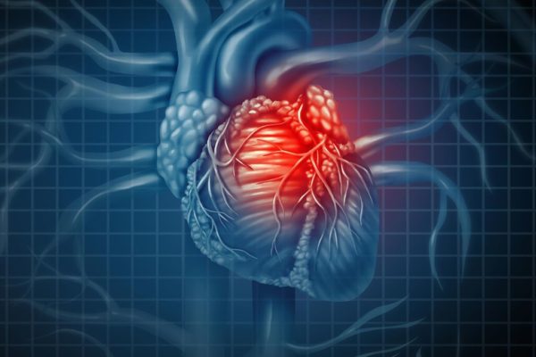 Unusual heart metabolism could be a predictor of potential sudden cardiac death